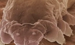Mite demodex și caracteristici ale mijloacelor sale de trai