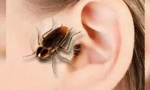 Trackan în ureche: simptome și extracție