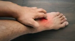 Alergie pentru a mușca flori în om