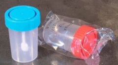 Analiza ouălor pe ouă