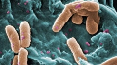 Ce diferă eucariote de la prokaryot?