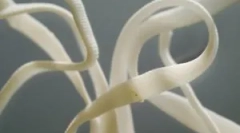 Cât de periculoși viermi de panglici la oameni și simptomele lor