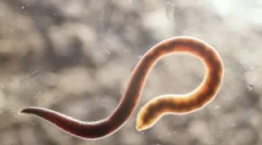 Care sunt stâlpii și tratamentul lor