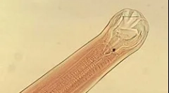 Ce este anchilostomul?