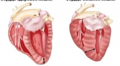 Ce este cardiomiopatia hipertrofică în pisici și ceea ce este periculos