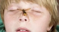 Acțiunile părinților, dacă bebelușul bit waspul