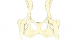 Afișaje ale îmbinărilor de șold la câini: diagnostic, tratament și previziuni