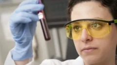 Cum se efectuează testul de sânge pe toxoplasmoză