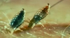 Ce mușcă păduchii?