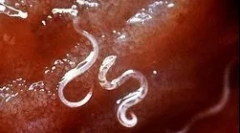 Cum trăiește și dezvoltă malaria plasmodium