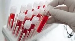 Ce teste de sânge pe paraziți trebuie să treacă?