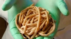 Ce viermi trăiesc în corpul uman