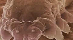 Mite demodex și caracteristici ale mijloacelor sale de trai