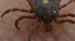 Erlihioza monocitare magică