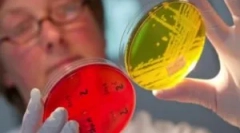 Tratamentul enterodiozei la copii și adulți