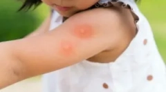 Instrumente de top din țânțarii pentru copii