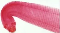 Cele mai comune tipuri de viermi la om