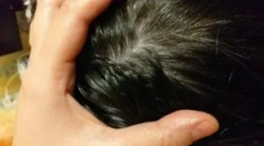 Acasă populară remedii de la păduchi și gid