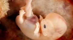 Ontogeneza și modelele inerente