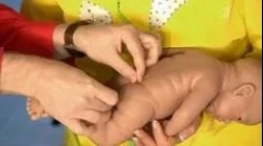 Caracteristici de luare a domeniului de aplicare a enterobiozei