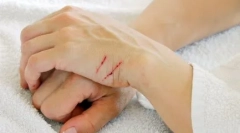 De ce se luptă cu pisicile