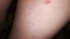 De ce unii oameni mușcă purici, și nu există alții