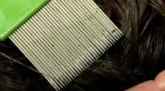 Procedura de finalizare pentru păduchi și nd