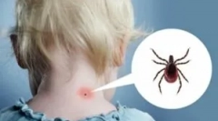 Reacția corpului și spațiile de mușcătură