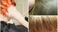 Vopseaua de păcăli păduchii ucide?