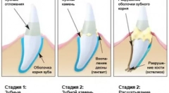 Îngrijirea predatorului de casă - curățarea cattick