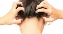 Tipuri de insecte parazitare în capul omului