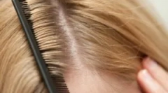 Sortează păduchi la om