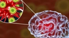 Encefalita virală a creierului: specii și simptome