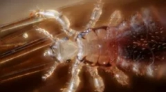 Păduchi ca transportatorii de boală